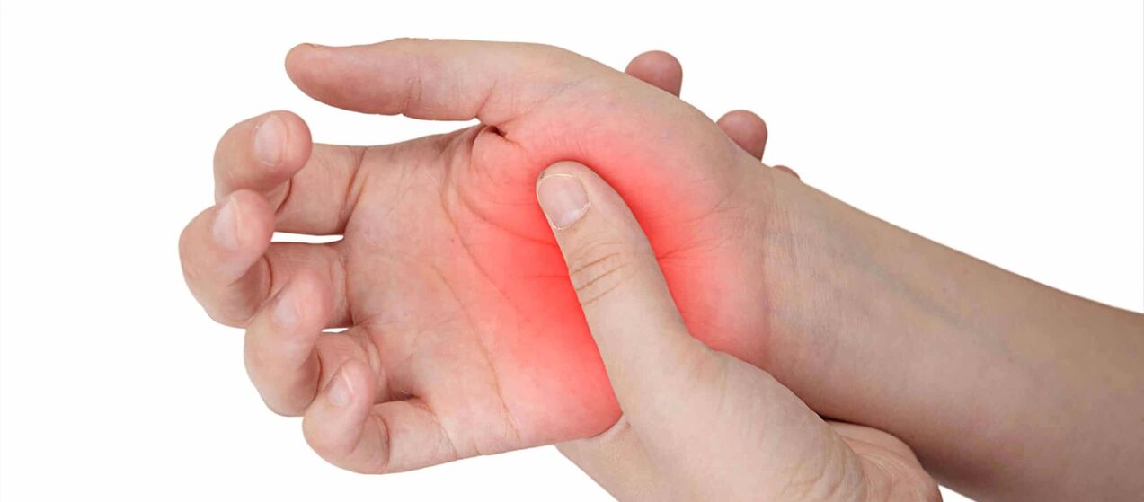 Dolor y enrojecimiento en el área de la articulación que acompañan al desarrollo de artrosis. 