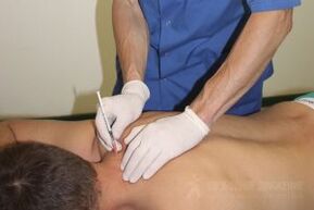 Tratamiento pasivo de la osteocondrosis