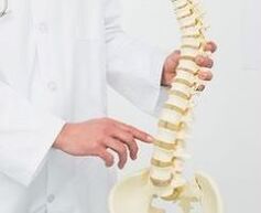 Osteocondrosis lumbar