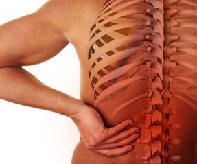 dolor de espalda con osteocondrosis lumbar