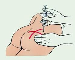 inyecciones para el tratamiento de la osteocondrosis