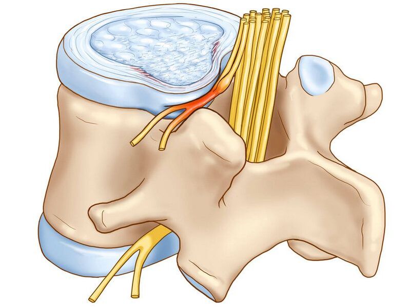 La columna vertebral es otra posible fuente de dolor.