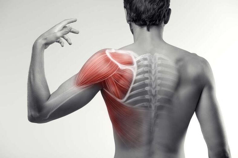 área de dolor muscular
